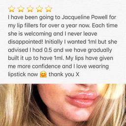 Revolax Dermal Fillers great for Lip Enhancements, Anti aging, solutions such as wrinkle treatments, face contouring, skin rejuvenation and hydration. Free Consultation. Read the comments above from one of my happy customers.