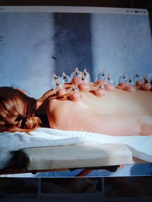 Buy & Sell West Yorkshire Leeds - Photos for Suction cupping and massage treatments.