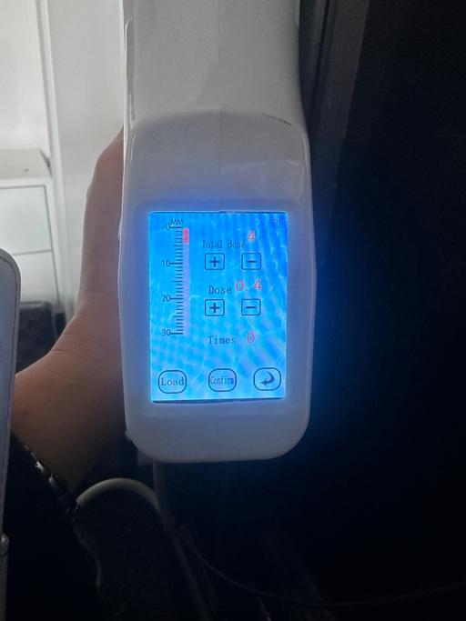 Buy & Sell South West London Streatham - South West London - Photos for Electric Hyaluron Pen for lip fillers, cheek