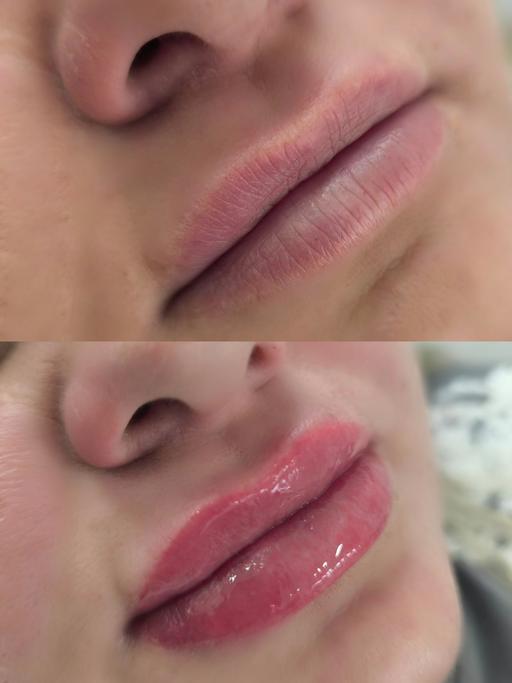 Buy & Sell Barbican Central London - Photos for lip pigmentation