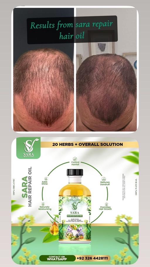 Buy & Sell The Broadway Bradford - Photos for Hair growth oil