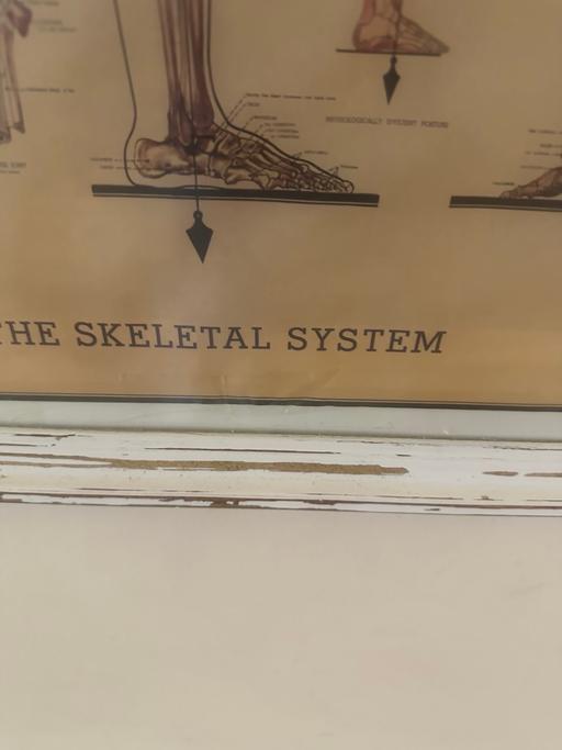  — Skeleton