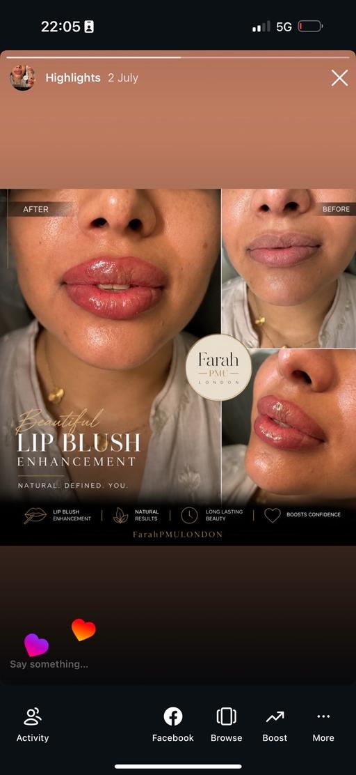  — Lip blush